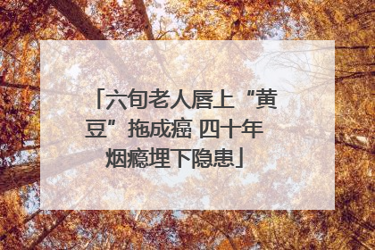六旬老人唇上“黄豆”拖成癌 四十年烟瘾埋下隐患